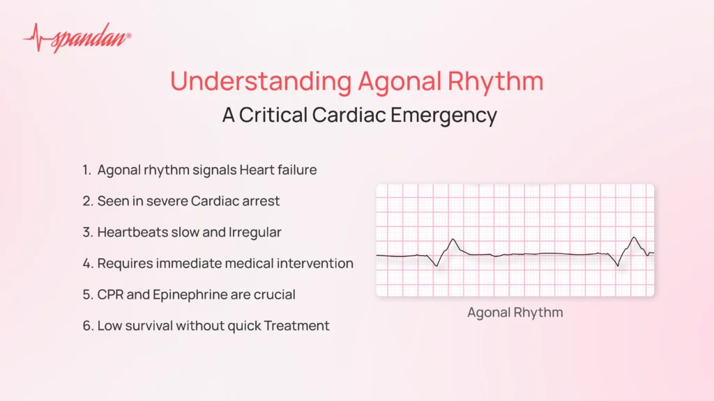 agonal rhythm