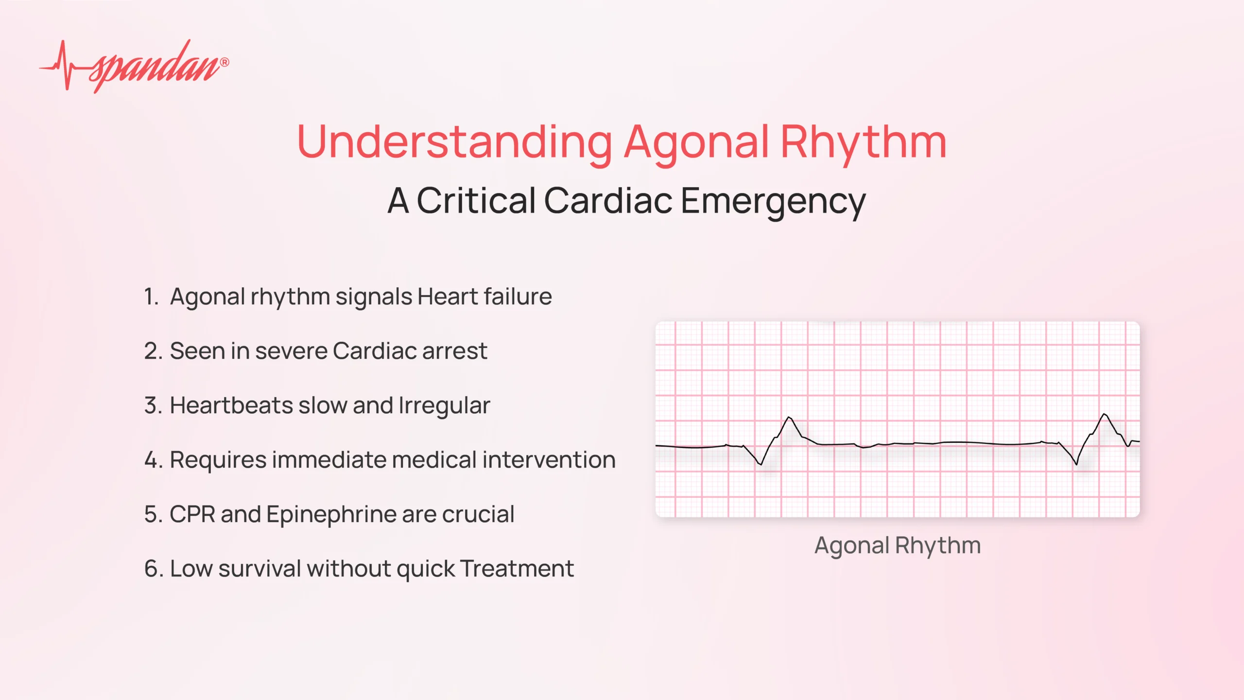 agonal rhythm