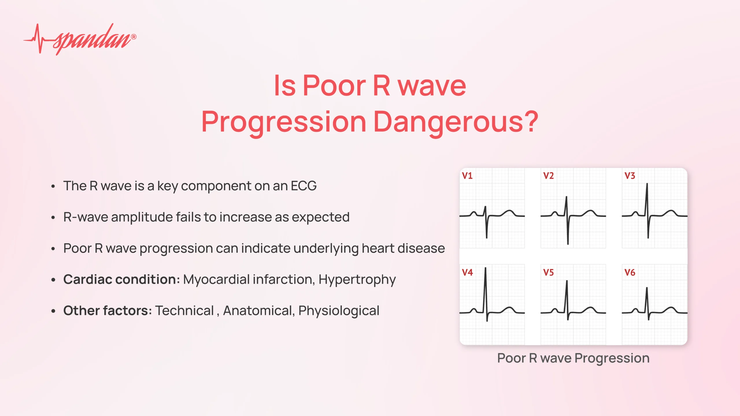 is poor r wave progression dangerous