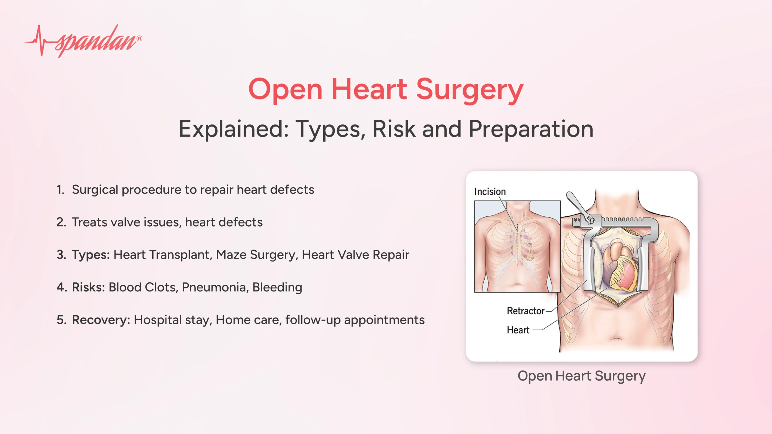 open heart surgery