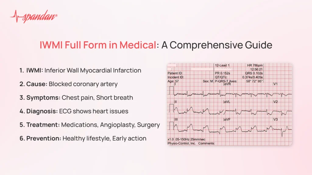 iwmi full form in medical