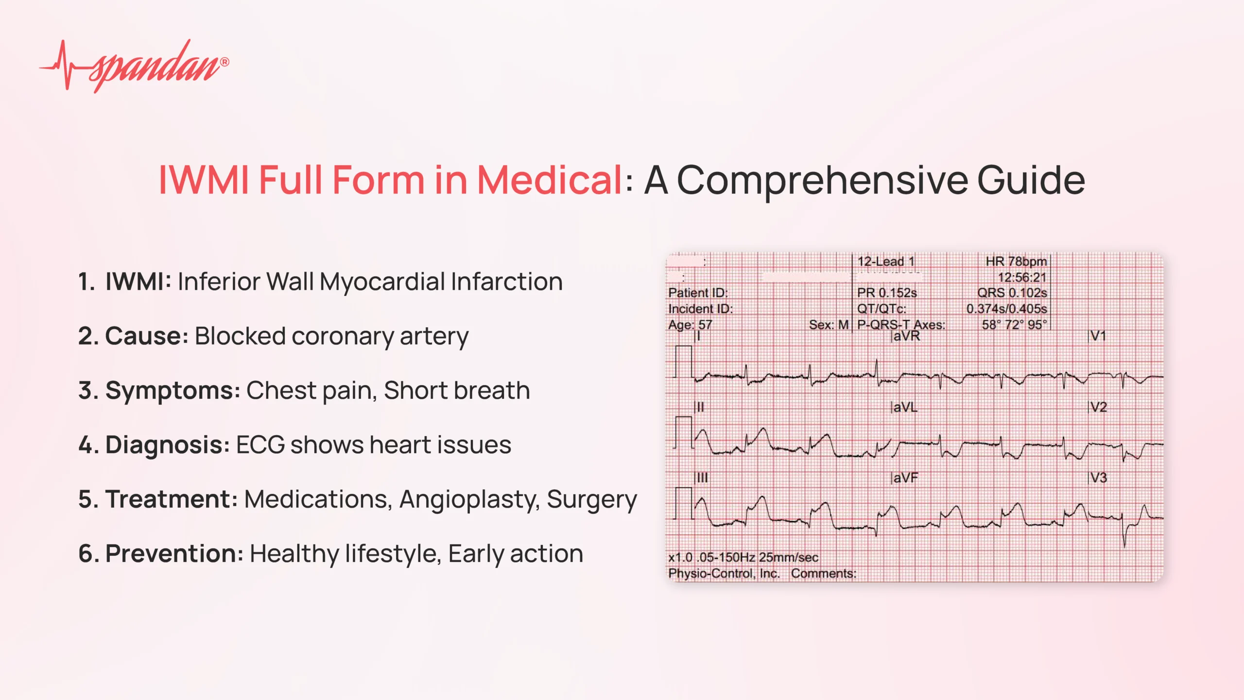 iwmi full form in medical