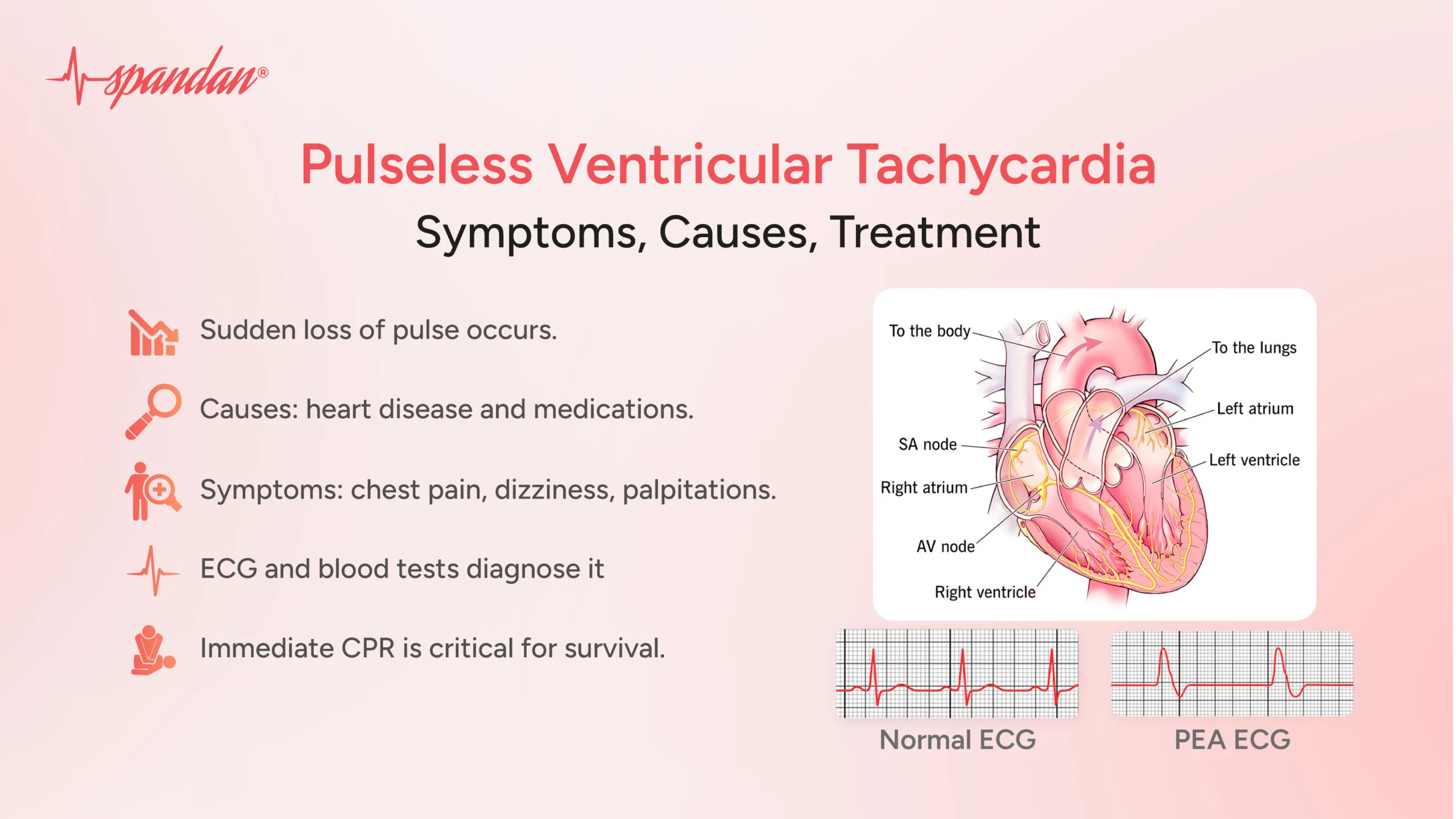 pulseless ventricular tachycardia