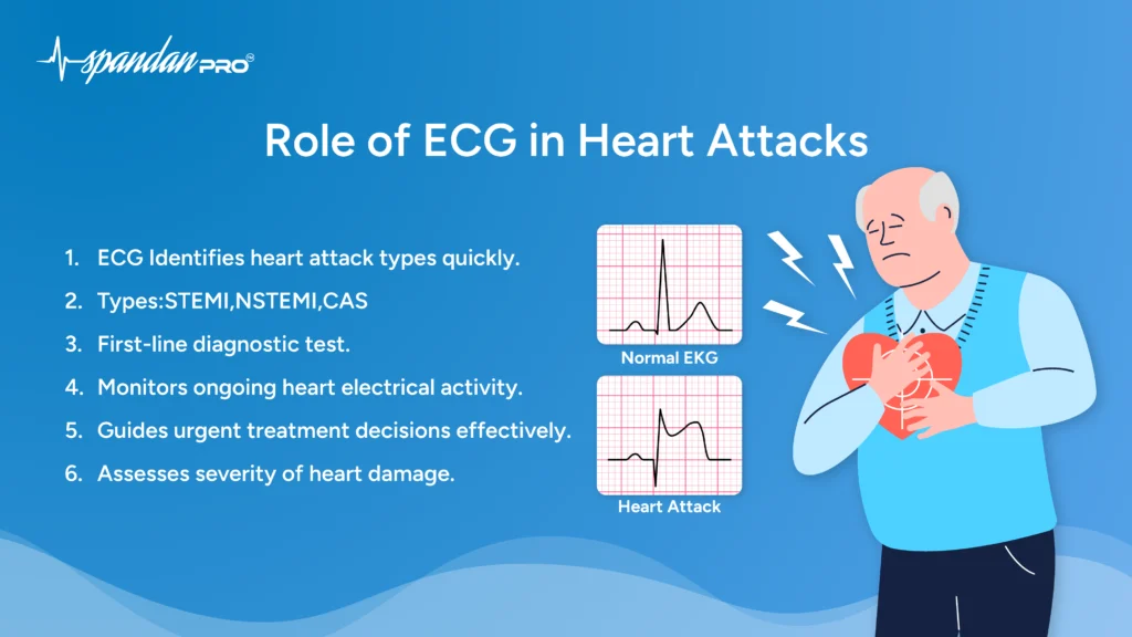 Role of ECG in Heart Attacks