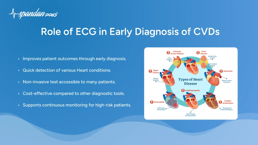 Role of ECG in Early diagnosis of CVDs