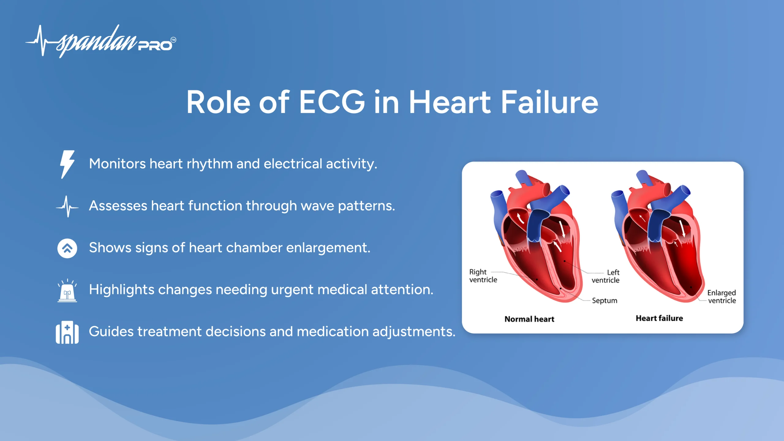 Role of ECG in Heart Failure
