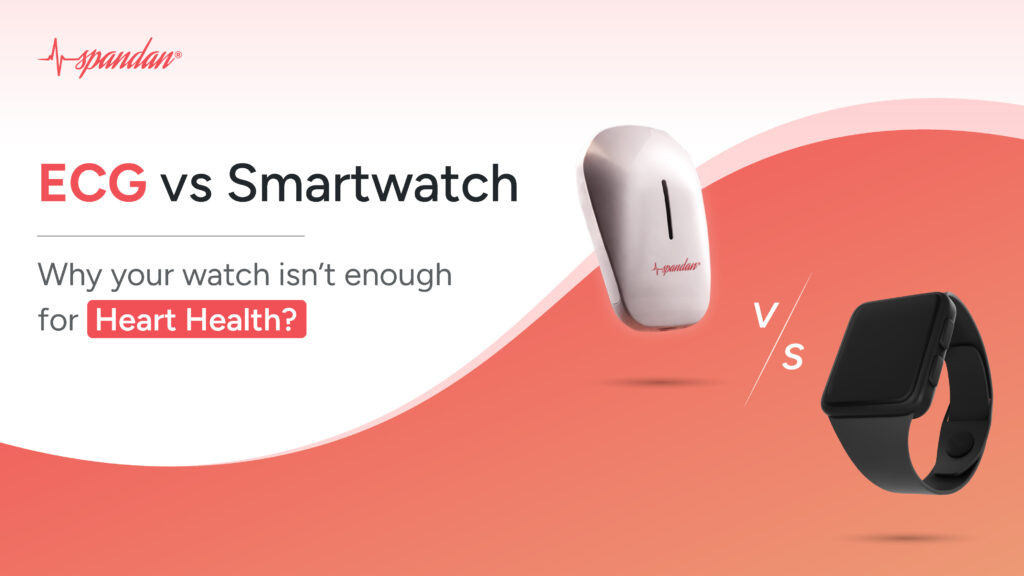 ECG vs smartwatch