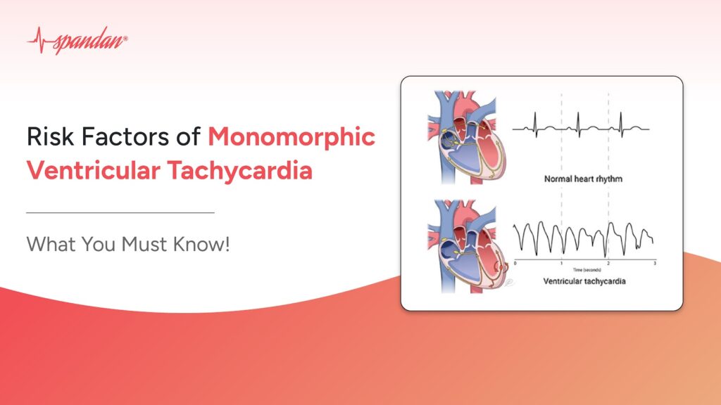 Risk Factors of Monomorphic Ventricular Tachycardia