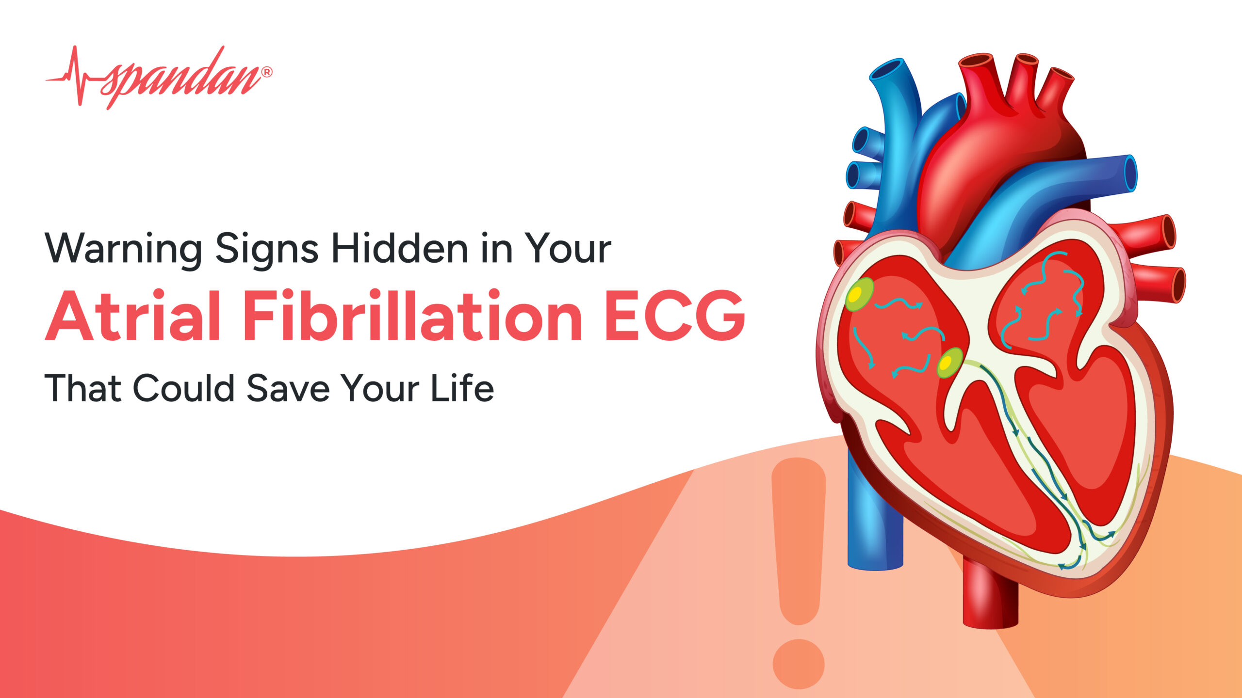 atrial fibrillation ecg